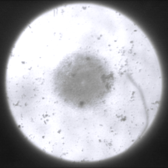 Screen showing crowd of bacteria in the center
