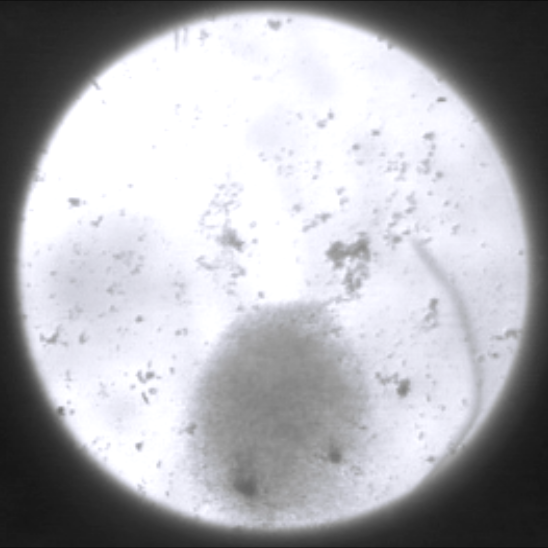 Screen showing bacteria swimming downward
