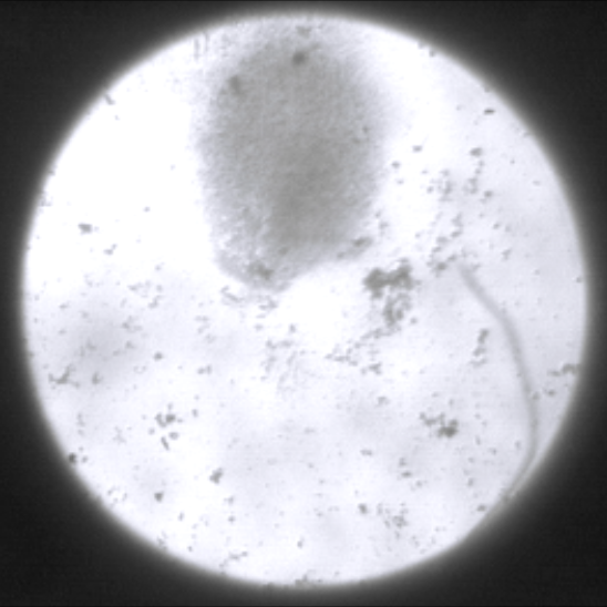 Screen showing crowd of bacteria swimming upward