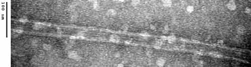 Electron Micrograph of MT